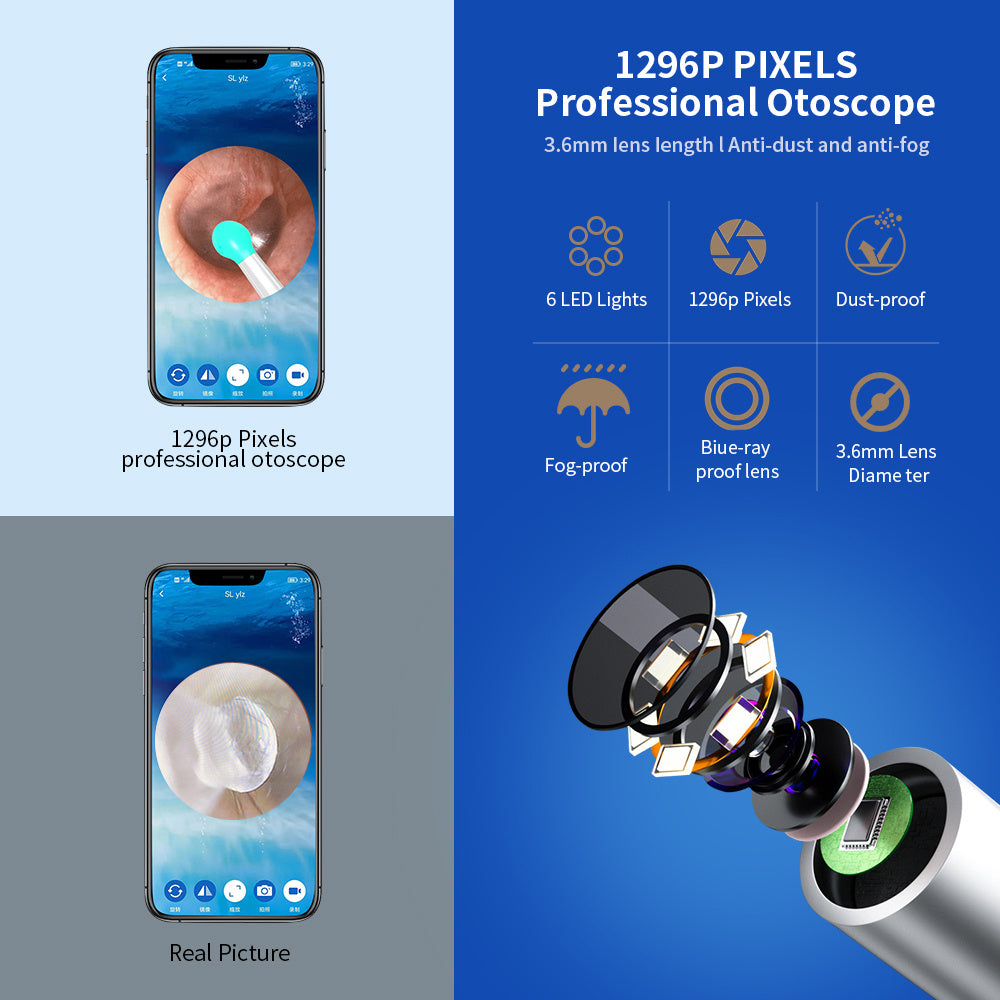 NE3 Ear Cleaner Otoscope Ear Wax Removal Tool With Camera LED Light Wireless